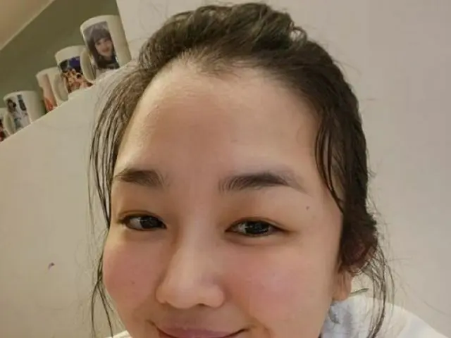 “舌がん闘病中”の歌手チョン・ミエ、ステージ3発覚後8時間の大手術も明るい笑顔で近況「大丈夫です」（画像提供:wowkorea）
