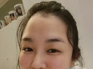 “舌がん闘病”の歌手チョン・ミエ、ステージ3発覚後8時間の大手術も明るい笑顔で近況「大丈夫です」