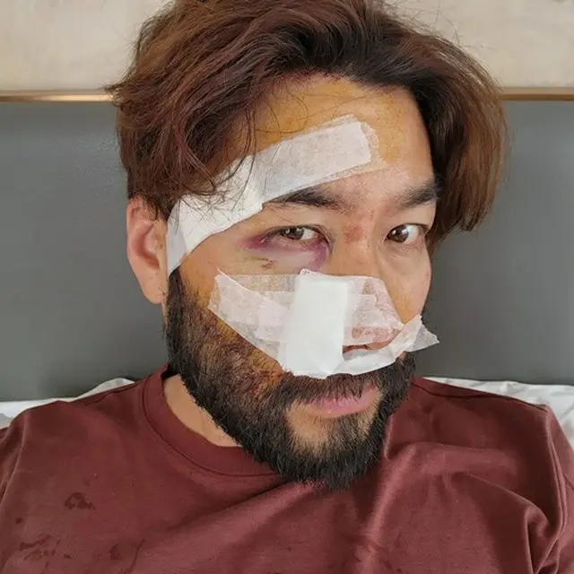 「もう大丈夫」タレントのノ・ホンチョル、事故がどれほどひどかったのか「衝撃写真」公開…「急いで訪ねたところが名医だった」（画像提供:wowkorea）