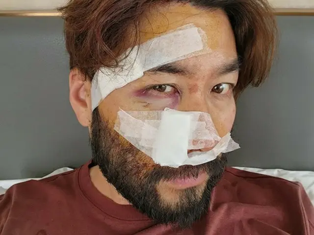 「もう大丈夫」タレントのノ・ホンチョル、事故がどれほどひどかったのか「衝撃写真」公開…「急いで訪ねたところが名医だった」（画像提供:wowkorea）