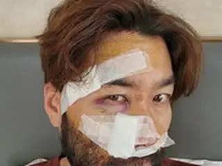 「もう大丈夫」タレントのノ・ホンチョル、事故がどれほどひどかったのか「衝撃写真」公開…「急いで訪ねたところが名医だった」