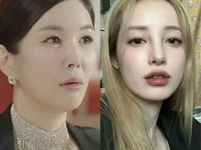 整形した事実をクールに告白する芸能人が増加中1（画像提供:wowkorea）