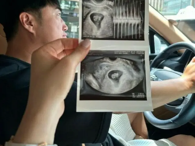 お笑い芸人チャン・ドンミンの妻チュ・ユジン、超音波写真公開（画像提供:wowkorea）
