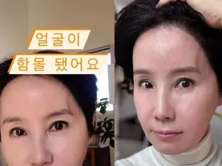 歌手パク・ヘギョン、寝て起きたら顔が陥没…一体何が起こったの？…“理由もなく…怖い”