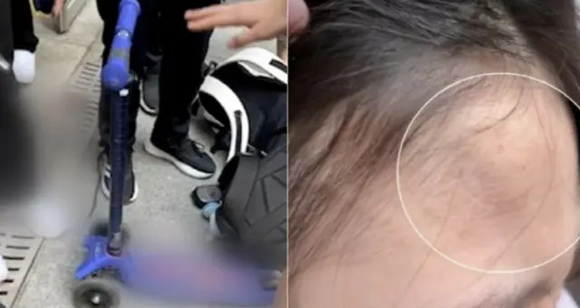3階からキックボード投げた小学生…中学生2人が負傷＝韓国