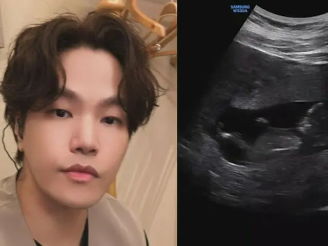 “ソン・シギョンらも祝福”歌手ナ・ユングォン、結婚3か月で妻の妊娠発表…「12月に会おう」