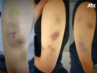 「気絶しても殴り続けた」…宿所に無断侵入し女子高生を無差別暴行したテコンドーコーチ＝韓国