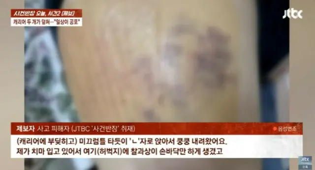 エスカレーターからスーツケース2つが転がり落ちる…全治8週間のけがをした女性＝韓国2
