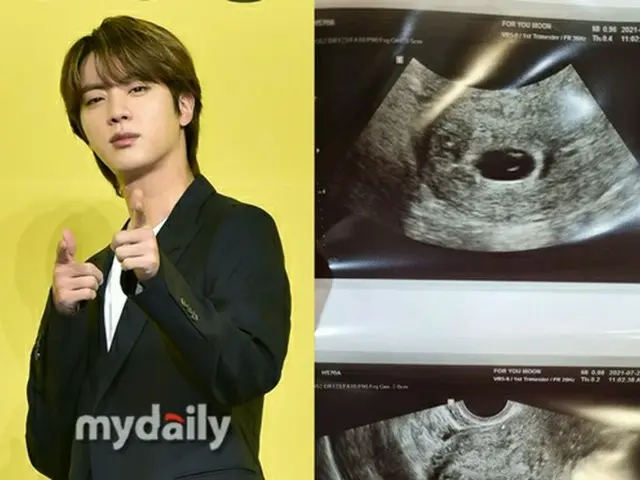 「BTS（防弾少年団）」ジン、叔父さんになる...直接つけたニックネームは「バター」