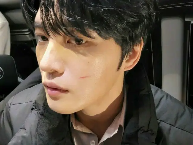 キム・ジェジュン、誘惑のコメント…”傷の治療をしてくれる人、どこかにいないかな”