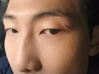 「BTS（防弾少年団）」RM、 ハンサムな顔に深い傷が…痛々しい目の上の傷を公開
