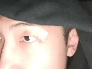 「BTS（防弾少年団）」RM、目の上の傷は大丈夫？