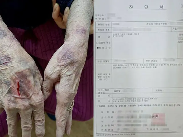 「骨折するほど」入所者に暴行…老人センター職員5人を立件=韓国(画像提供:wowkorea)